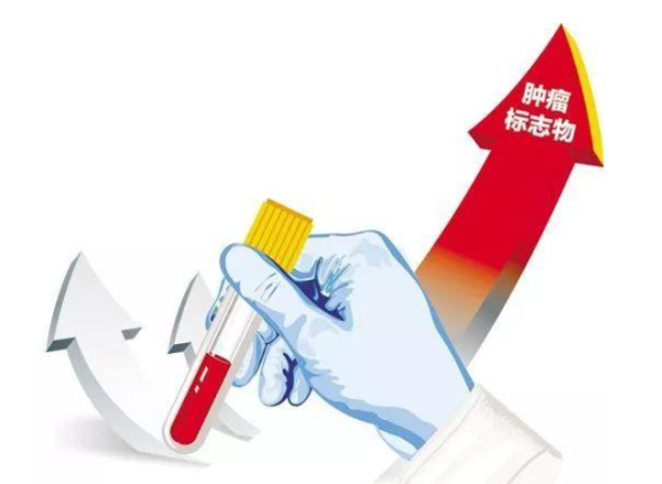宏盈国际 了解常用肿瘤标志物及其临床意义